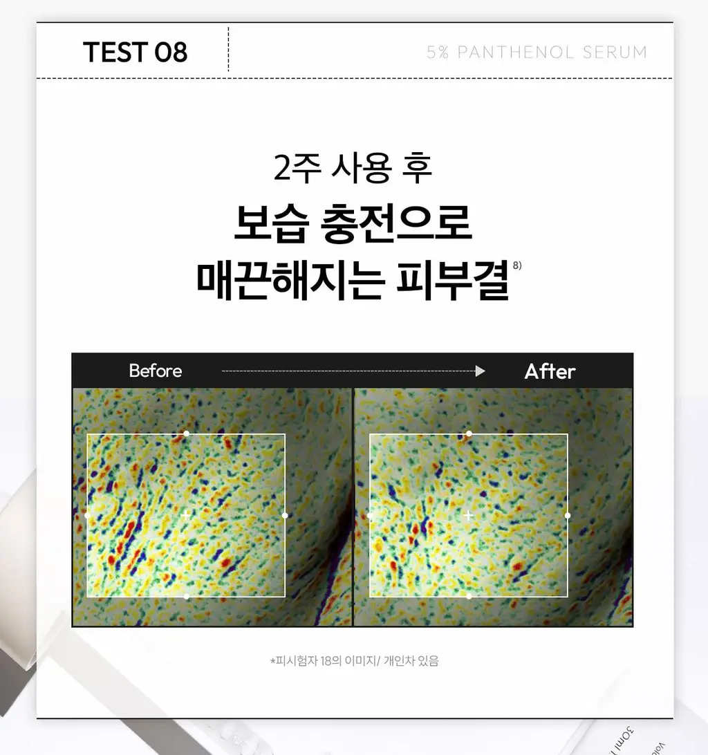 [1+1/속보습 진정세럼] 레이어랩 니오좀 판테놀 5% 세럼 30ml+30ml 더블 기획 상세페이지 31